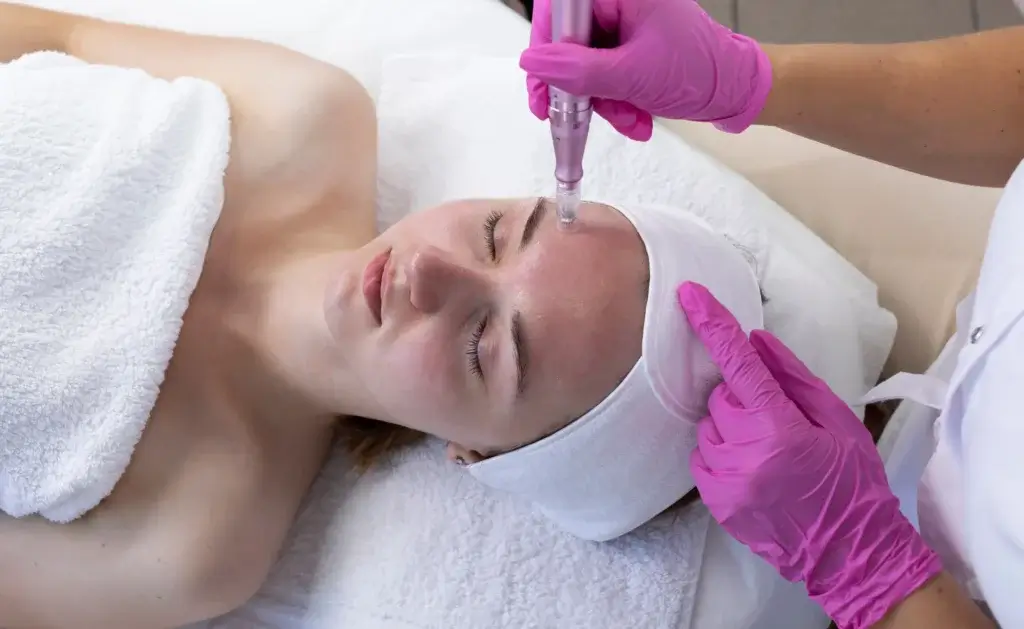 Microneedling by TruBody Wellness & Aesthetics, LLC in Rosharon, TX